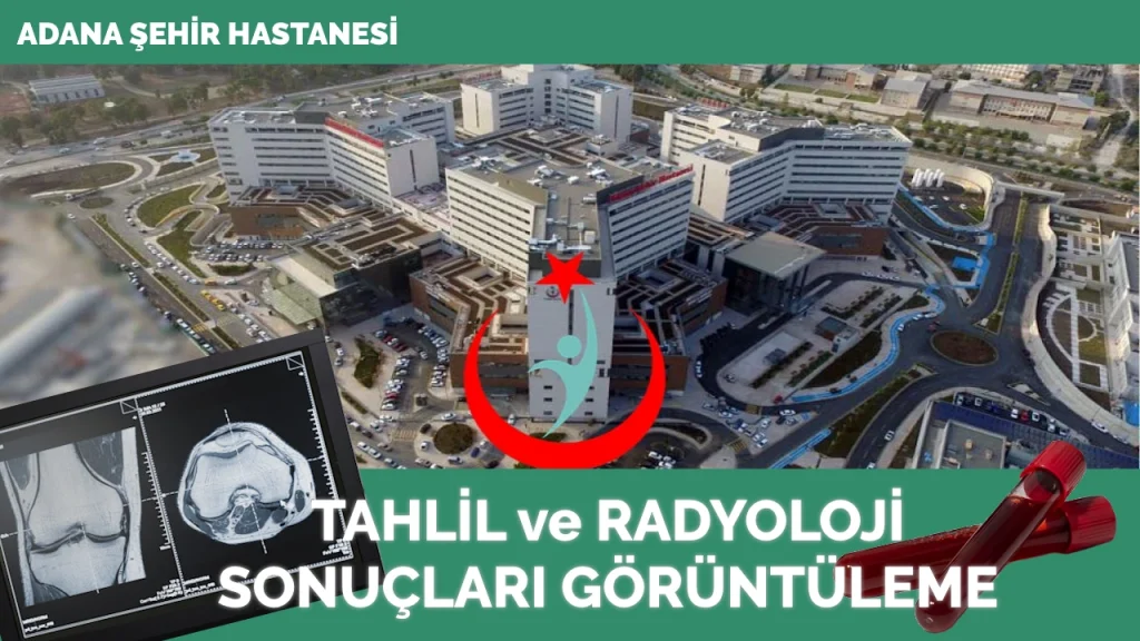 Adana Şehir Hastanesi Tahlil Ve Radyoloji Sonuçları - Sonuç Sorgula