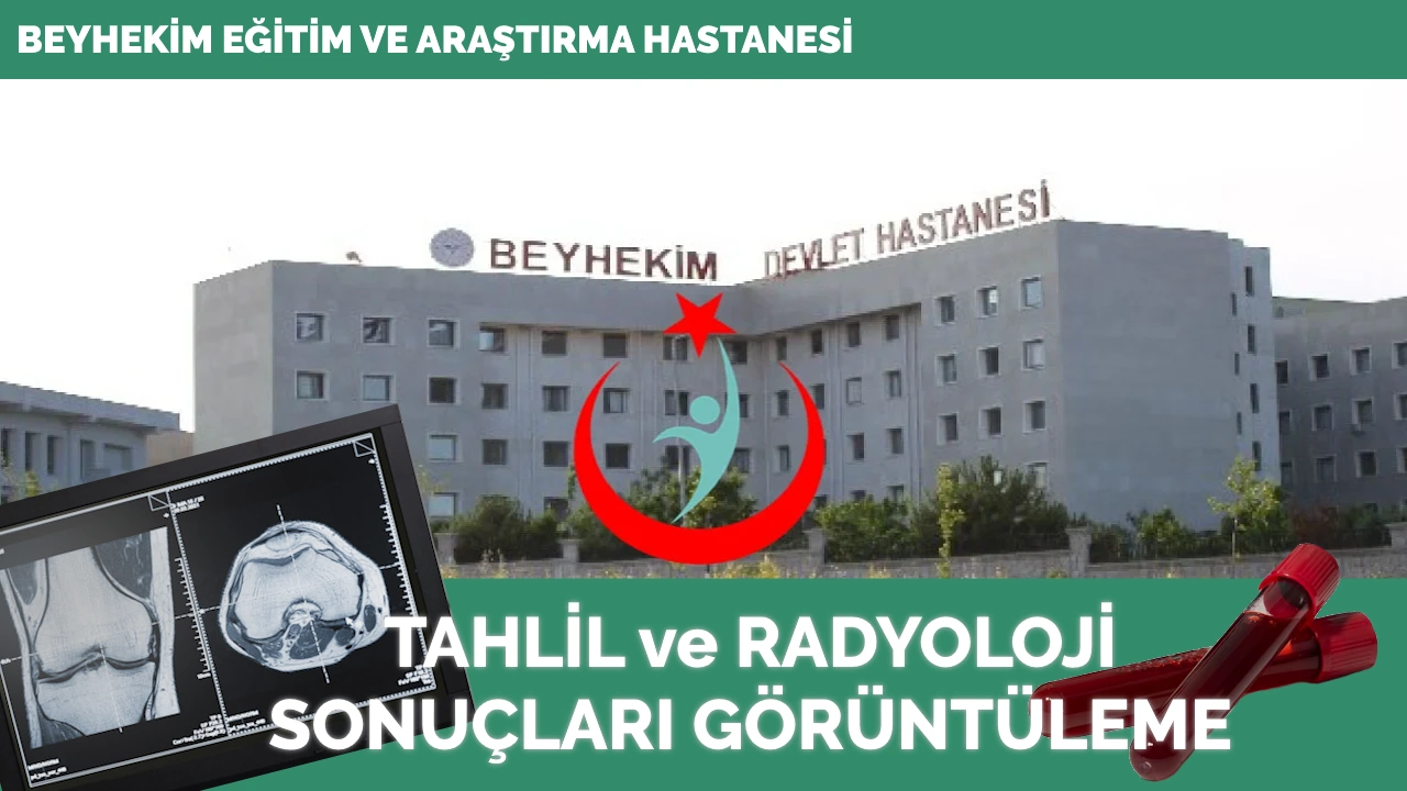 Konya Beyhekim E.A.H Tahlil Ve Radyoloji Sonuçları - Sonuç Sorgula