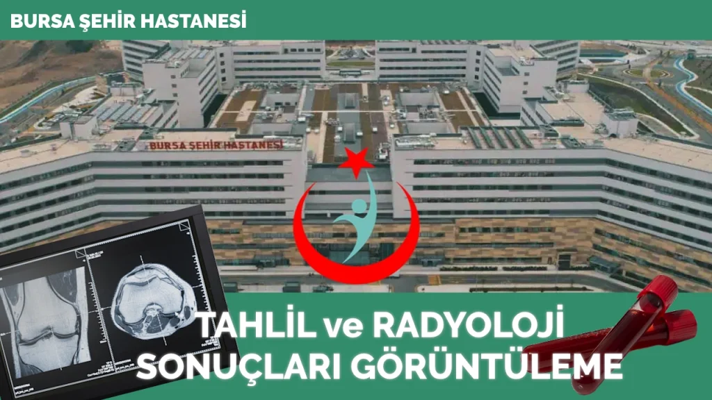 Bursa Şehir Hastanesi Tahlil Ve Radyoloji Sonuçları - Sonuç Sorgula