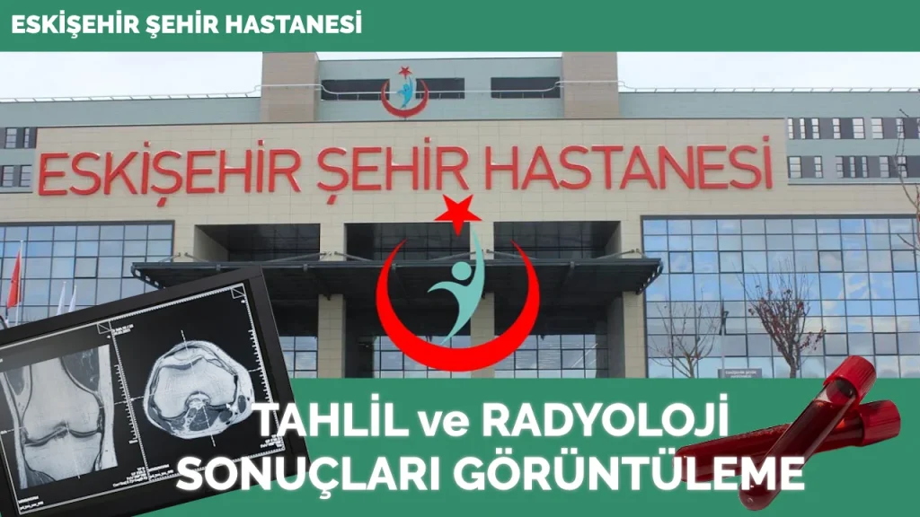 Eskişehir Şehir Hastanesi Tahlil Ve Radyoloji Sonuçları - Sonuç Sorgula