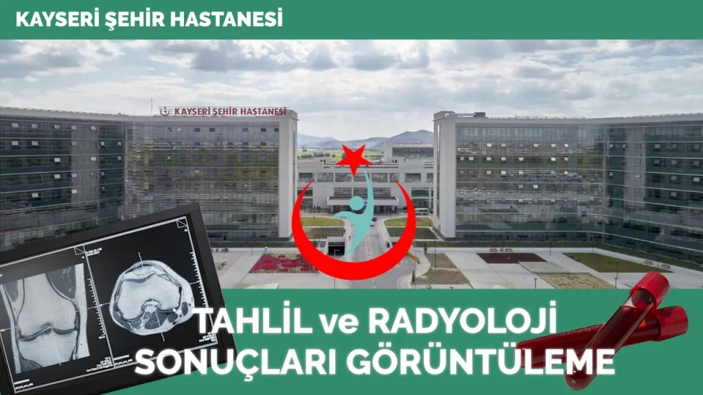 Kayseri Şehir Hastanesi