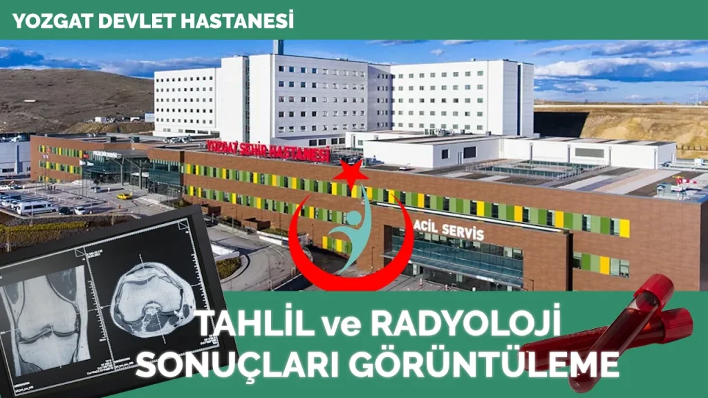 Yozgat Şehir Hastanesi